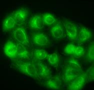Sophia and Richard Lunt made dramatic improvements in light-activated fluorescent dyes for disease diagnosis, image-guided surgery and site-specific tumor treatment. Courtesy of MSU
